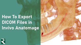 Invivo Anatomage - how to export DICOM files