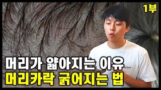 머리가 얇아지는 이유 & 머리 굵어지는 법 (Feat. 경험담, 두피염, 탈모) - Youtube