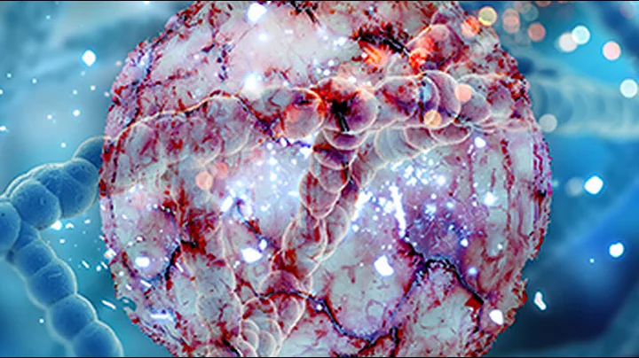 Ahead of the Game: Updates in Multi-Cancer Early Detection Tests