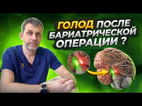 ГРЕЛИН. ЧУВСТВО ГОЛОДА после бариатрической операции | ЧТО ДЕЛАТЬ? Ответ бариатрического хирурга