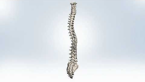 Precision Spine® Reform® Pedicle Screw System