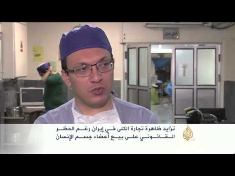 تزايد ظاهرة تجارة الكلى في إيران