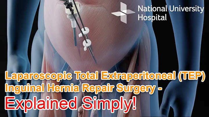 Laparoscopic Total Extraperitoneal (TEP) Inguinal Hernia Repair Surgery - Explained - DayDayNews