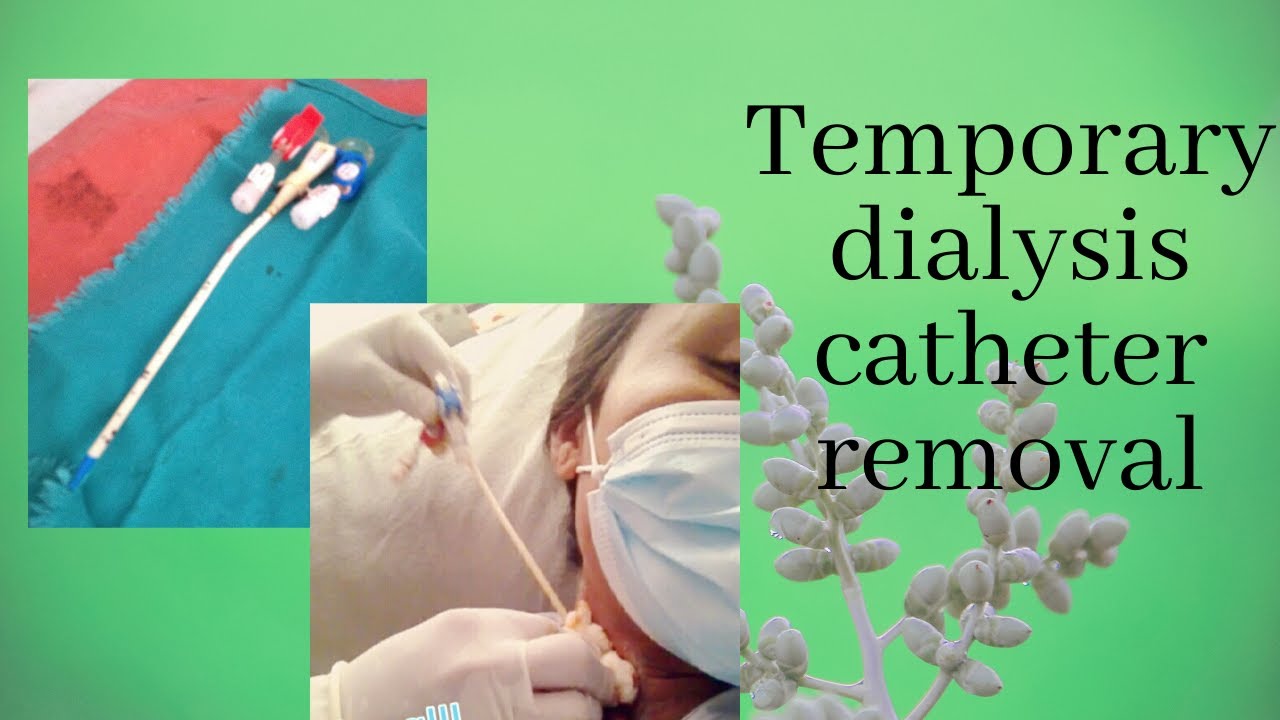 Temporary dialysis catheter removal/ hamocathetor removed/ Sangita's