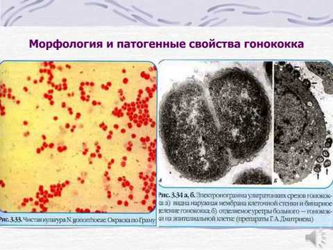 Видео: Какие структуры произошли от первой глоточной дуги?