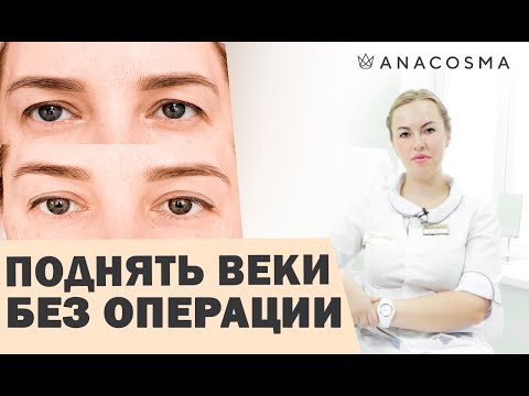Video: Slepo Veko Po Botoksu: Vzroki In Zdravljenje