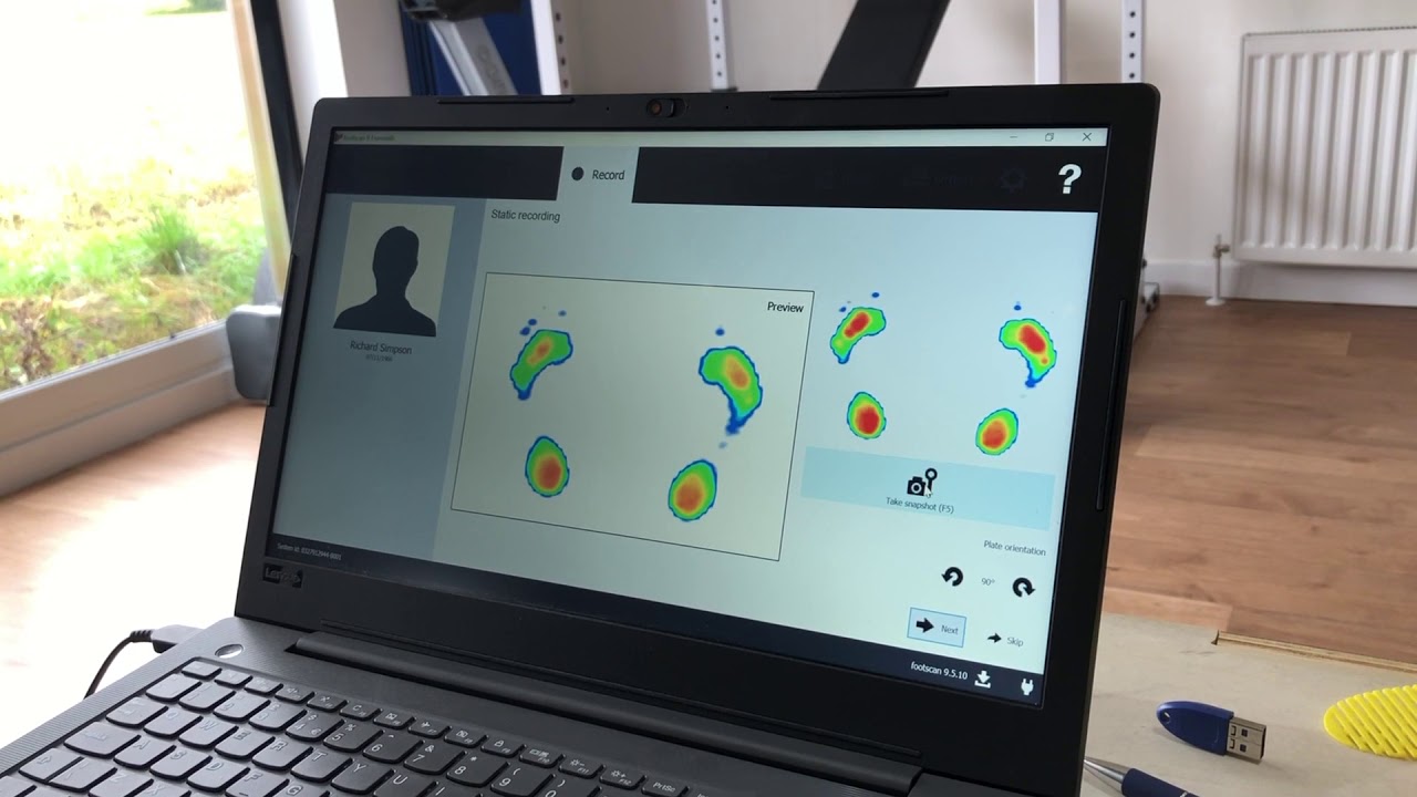 Willow House Footscan and clinic