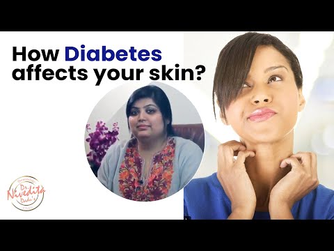 शुगर-के-कारण-होने-वाली-त्वचा-की-समस्याएं-|-skin-problems-caused-by-diabetes-dr.-nivedita-dadu's