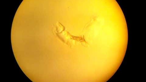 C. elegans "bag of worms"