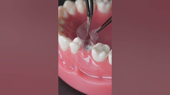 You Won’t Believe How Easy It Is to Fix Your Teeth! 😲🦷 But Why Is It Always So Expensive?