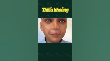 [3D] THIẾU KHOẢNG || Nha Khoa Quốc Tế Athena