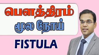 பததரம எனறல எனன What Is Fistula