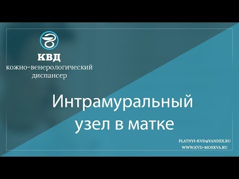 1058  Интрамуральный узел в матке