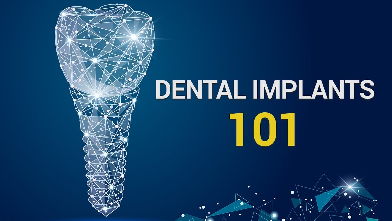 The Basics Of Dental Implants Woodbury Dental Arts YouTube