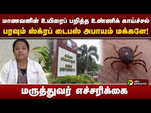 மாணவனின் உயிரை பறித்த உண்ணிக் காய்ச்சல்.. பரவும் ஸ்க்ரப் டைபஸ் அபாயம் மக்களே! மருத்துவர் எச்சரிக்கை