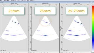 Dynamic Depth Focusing  - Technology Desing
