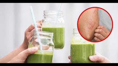 Nước Ép Cần Tây Rất Tốt, Nhưng 5 Nhóm Người Sau Không Nên Dùng