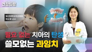 [KNN건강튜브] 어린 시절에 태어난 불필요한 치아?! 과잉치의 모든 것!