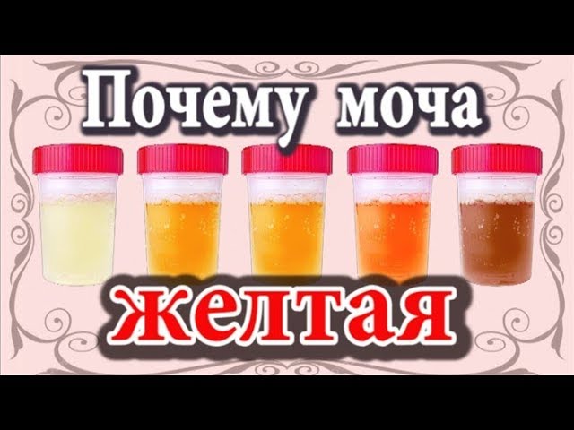 Почему моча желтая