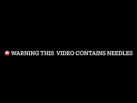 YouTube에서 Embryo transfer results - WARNING THIS VIDEO CONTAINS NEEDLES 보기 YouTube에서 Embryo transfer results - WARNING THIS VIDEO CONTAINS NEEDLES 보기