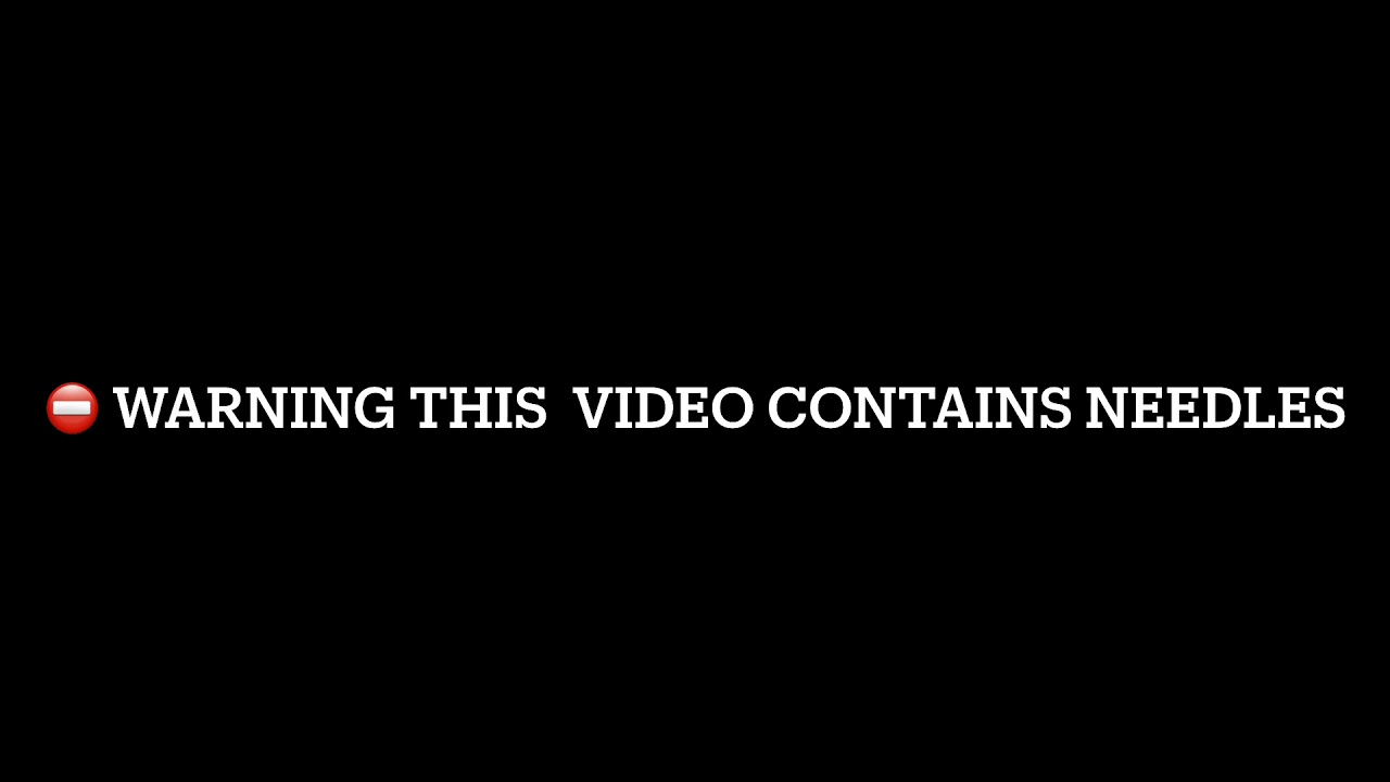 Guarda Embryo transfer results - WARNING THIS VIDEO CONTAINS NEEDLES su YouTube Guarda Embryo transfer results - WARNING THIS VIDEO CONTAINS NEEDLES su YouTube