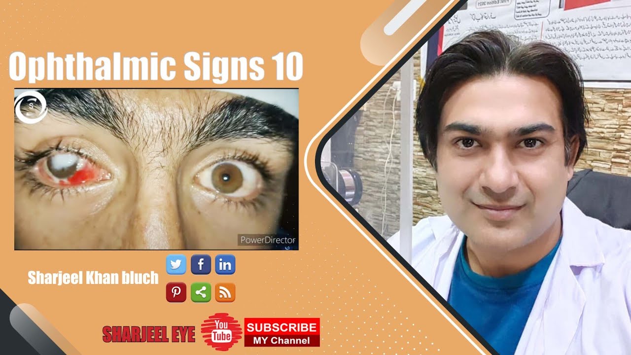 Ophthalmic Signs 10 - YouTube