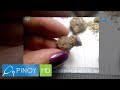 Pinoy MD: Kidney stones, paano ba masosolusyonan?