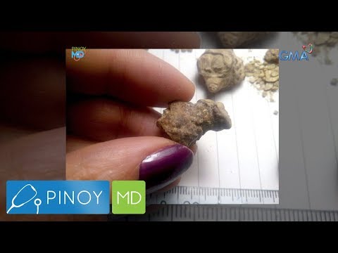 Video: Paano linisin ang palikuran mula sa bato sa ihi?