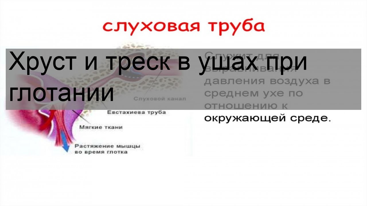 Треск в ушах при глотании. Трещит в ухе при глотании. Щелкает в ушах при глотании.