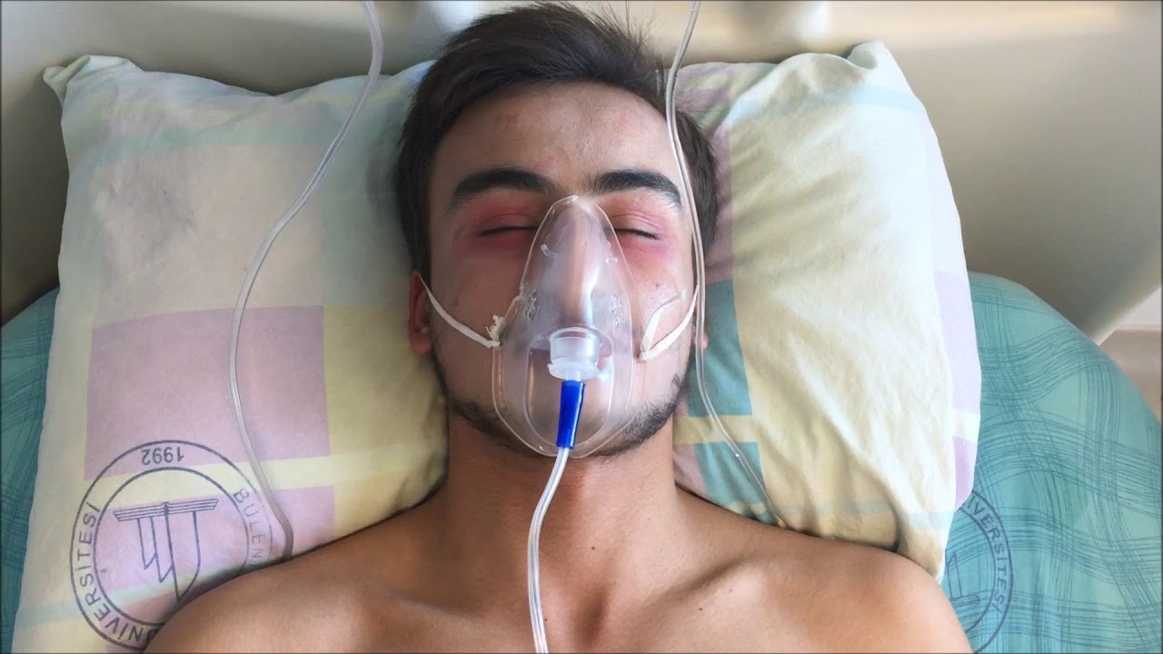 Terminal dönemdeki hasta