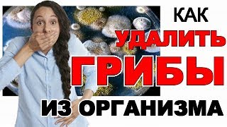 Не кормите грибов в организме! Смотреть всем!