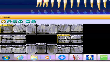 Guru7 Integration with Dentrix and Dexis