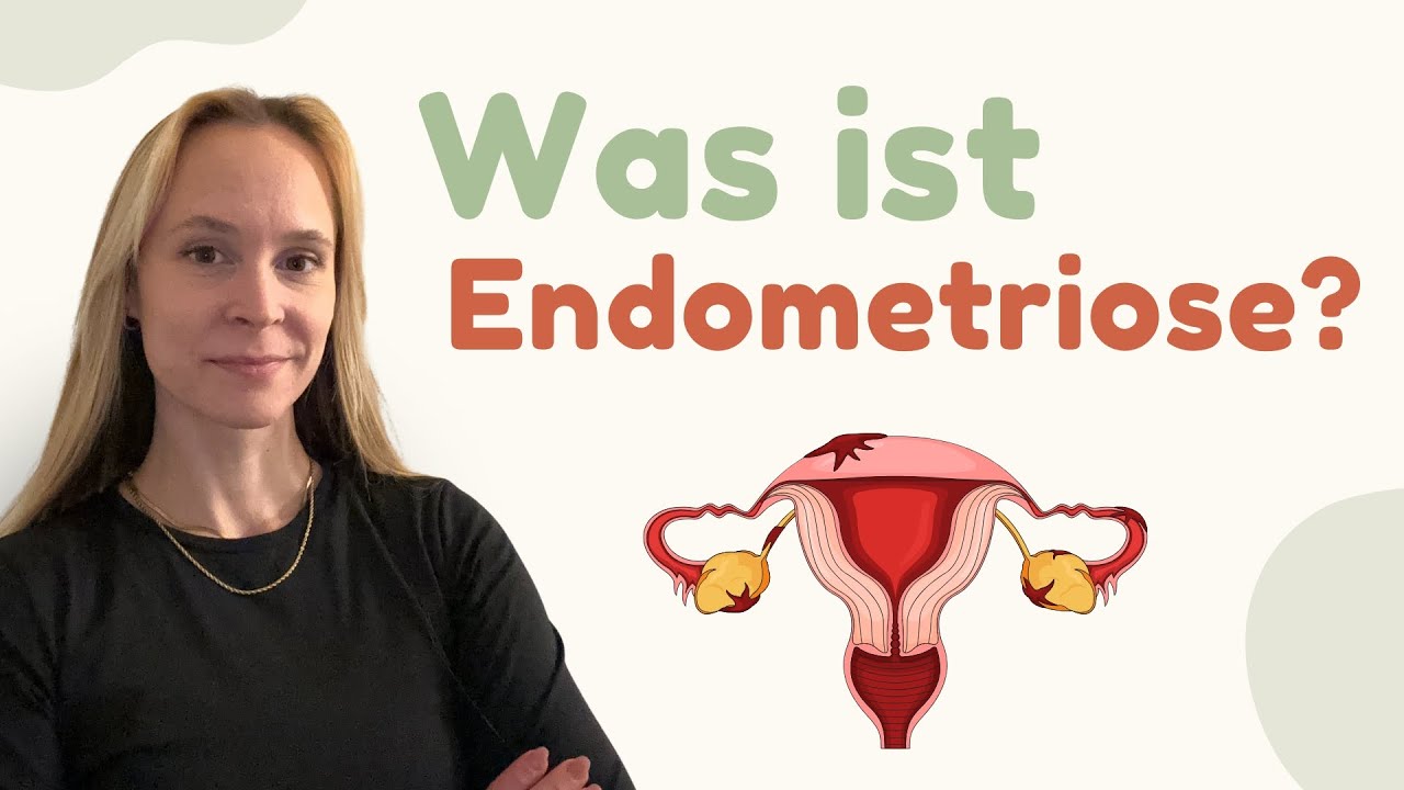 Was ist Endometriose und wie entsteht sie | Endometriose Erklärung, Ursachen & Symptome