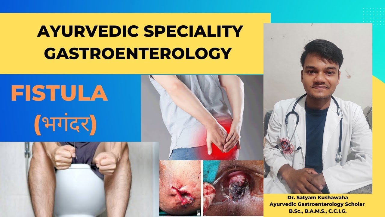 FISTULA IN ano treatment in Ayurveda (Ayurvedic Gastroenterology) YouTube