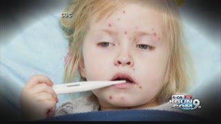 As measles bounces back, AZ health officials push vaccinations