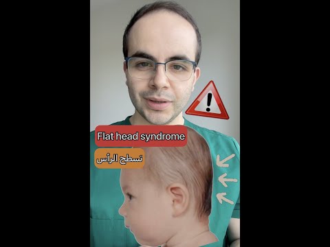 فيديو: من هو مسطح الرأس؟