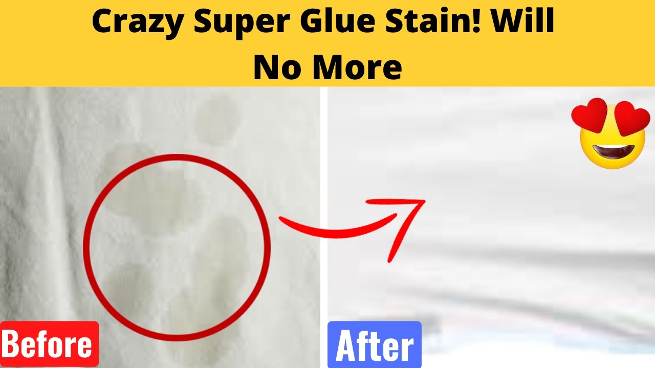 How to Get Glue out of clothes (With or Without Acetone)?