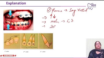 NEET MDS 2024 Ortho : Second order bends
