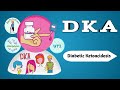 Diabetic Ketoacidosis || DKA