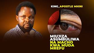 MIUJIZA ASUMBULIWA NA MACHO KWA MUDA MREFU _ KING APOSTLE MHUNI