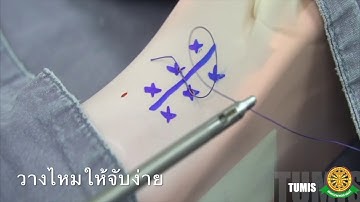 Basic laparoscopic box training (Module 2): Suturing technique