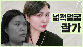 현실적으로 얼굴크기 줄이는 가장 확실한 방법 | 성형비포애프터 | 에이비성형외과