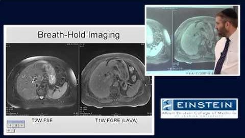 Introducing MRI: Fast Imaging Image Review (39 of 56)