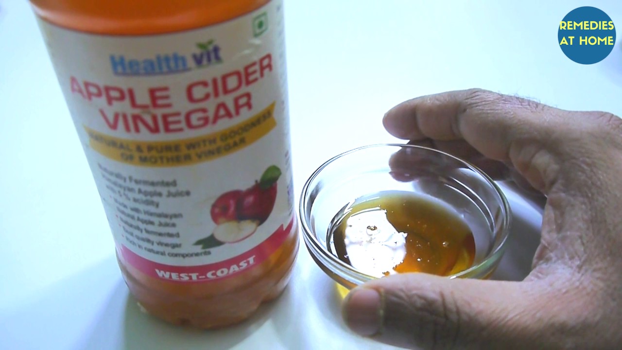 How To Get Rid From Acne Scars At Home With Apple Cider Vinegar