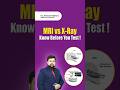 MRI vs X-Ray Explained | Which Test Do You Really Need? #MRIvsXRay