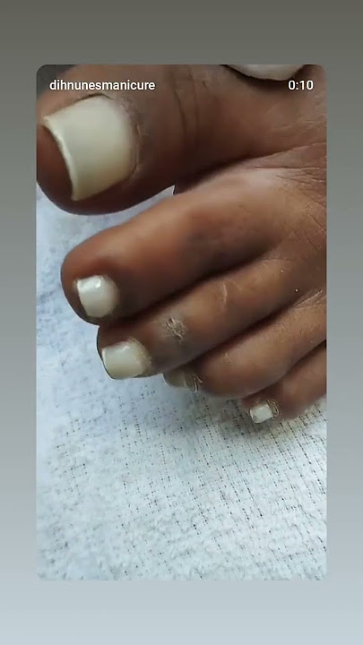 #transformaçãodemilhoes