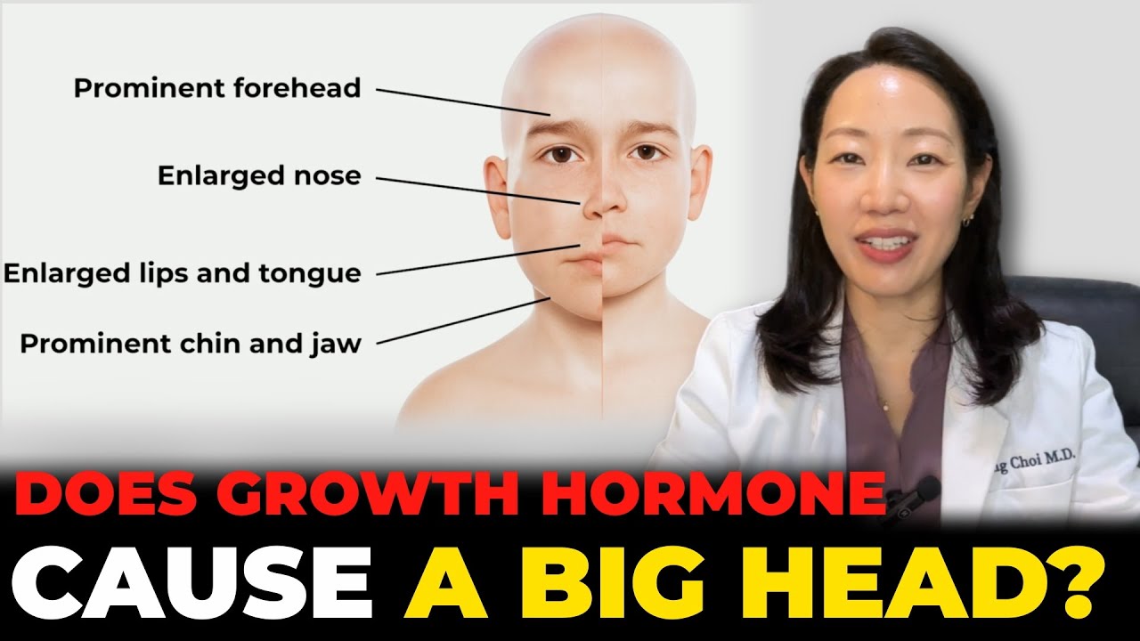 Will Growth Hormone Make My Child’s Head Bigger? The Truth Parents Need to Know.