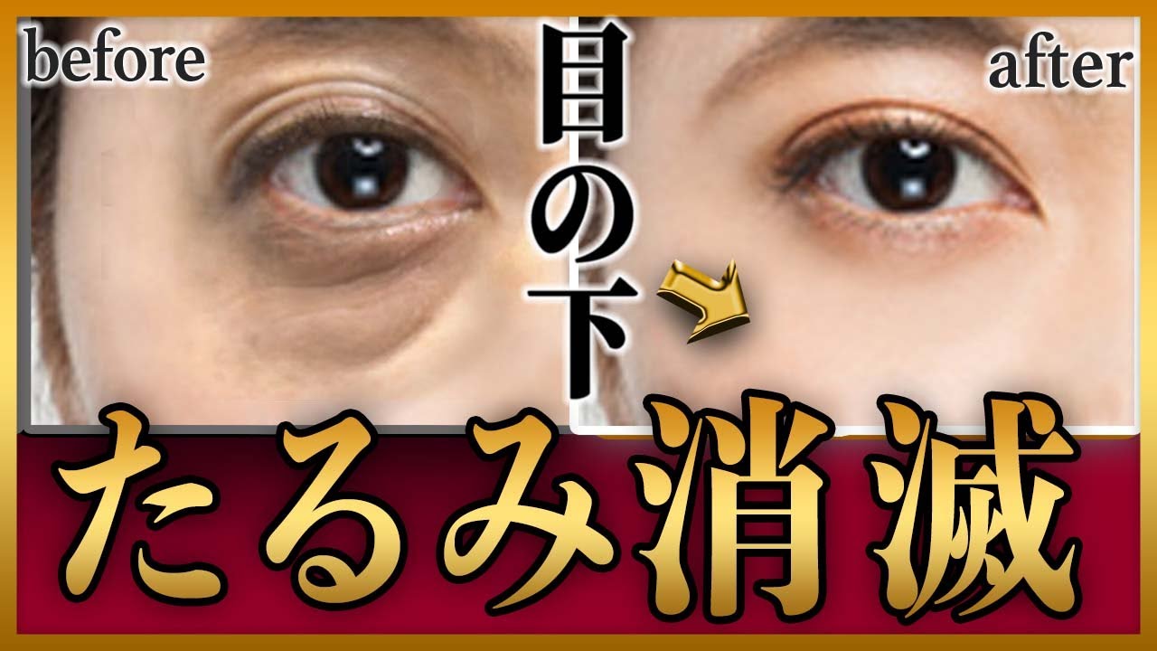Фундаментальное решение Устранение провисания под глазами