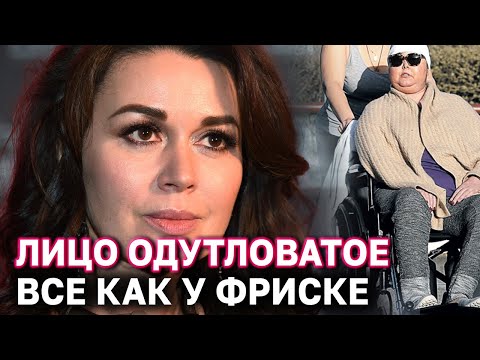 Video: Anastasiya Zavorotnyuk xəstəliyi zamanı və indi necə görünür