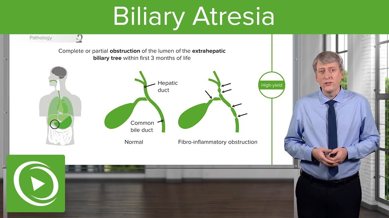 Biliary Atresia – Pediatrics | Lecturio